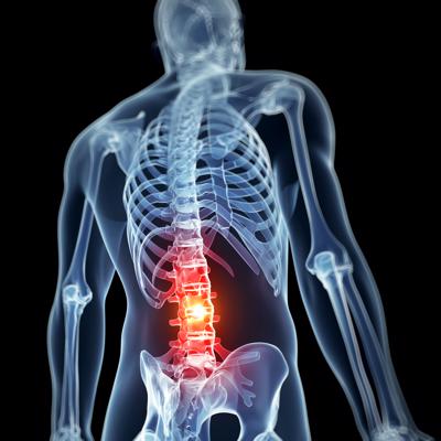 Contact a Brooklyn spinal cord injury lawyer with Cellino Law today.
